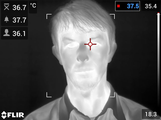 Fever Screening - Normal